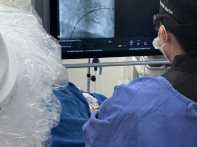 Médicos Cardiologistas do HBU realizam procedimento inédito em Marília e região para troca da válvula mitral. Avanço significativo na cardiologia intervencionista regional. Confira !