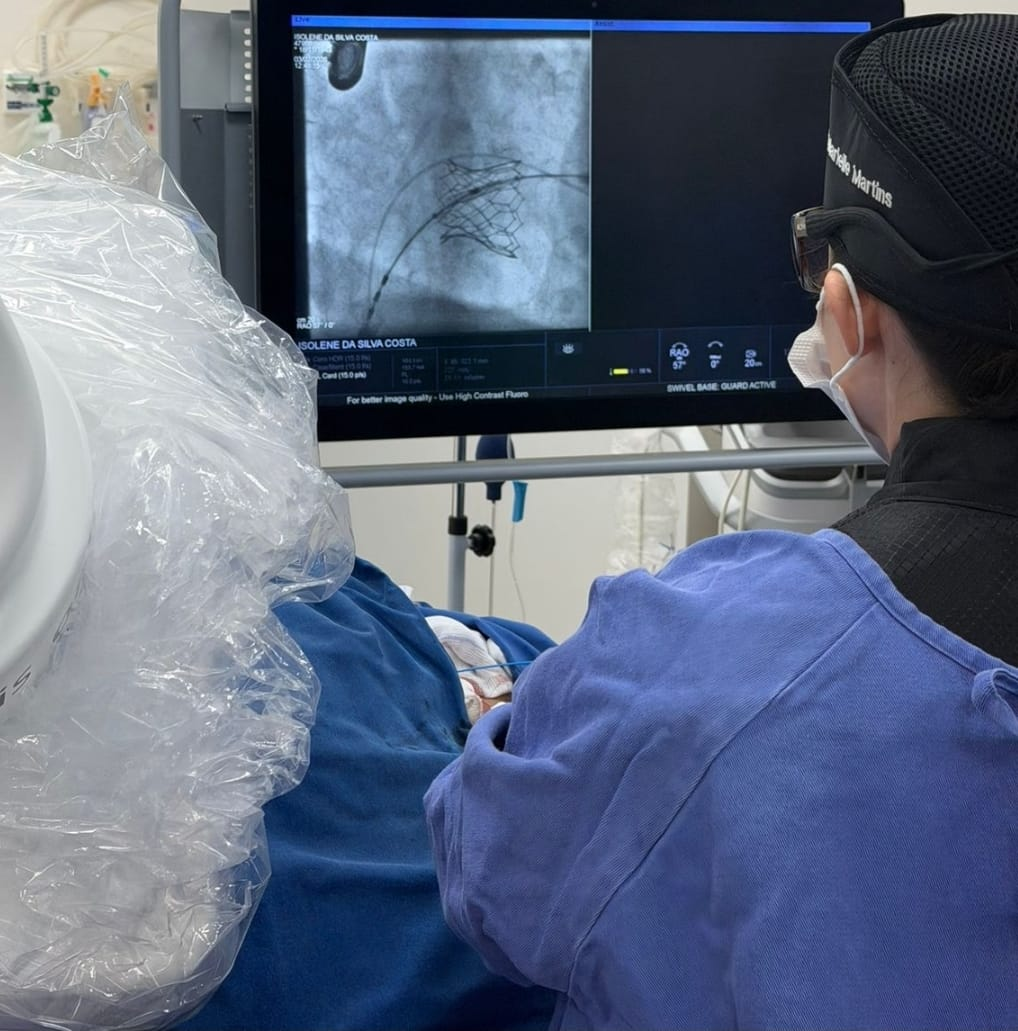 Médicos Cardiologistas do HBU realizam procedimento inédito em Marília e região para troca da válvula mitral. Avanço significativo na cardiologia intervencionista regional. Confira !