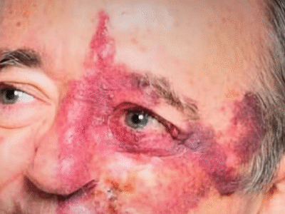 Ciência vive Era de Ouro na medicina com avanços rumo à cura do câncer