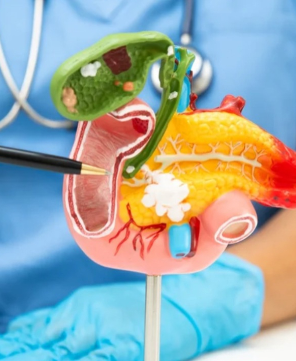 Médica diz o que colocar na dieta para evitar inflamação no pâncreas