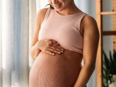 Por que estrias coçam tanto?