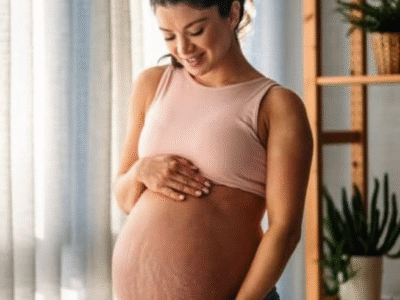 O que são estrias e por que elas coçam tanto? Veja como tratar a coceira e saiba também como removê-las combatendo a inflamação