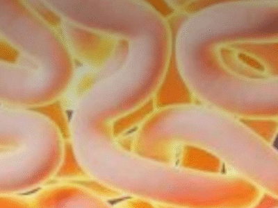 Considerado segundo cérebro, nutróloga explica como saber se intestino está inflamado; VEJA