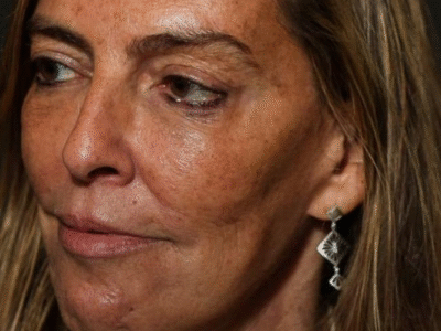 O Brasil perdeu a patente internacional da Polilaminina após cortes de recursos destinados a UFRJ em 2015 e 2016 no governo Dilma, diz pesquisadora; VEJA VÍDEO