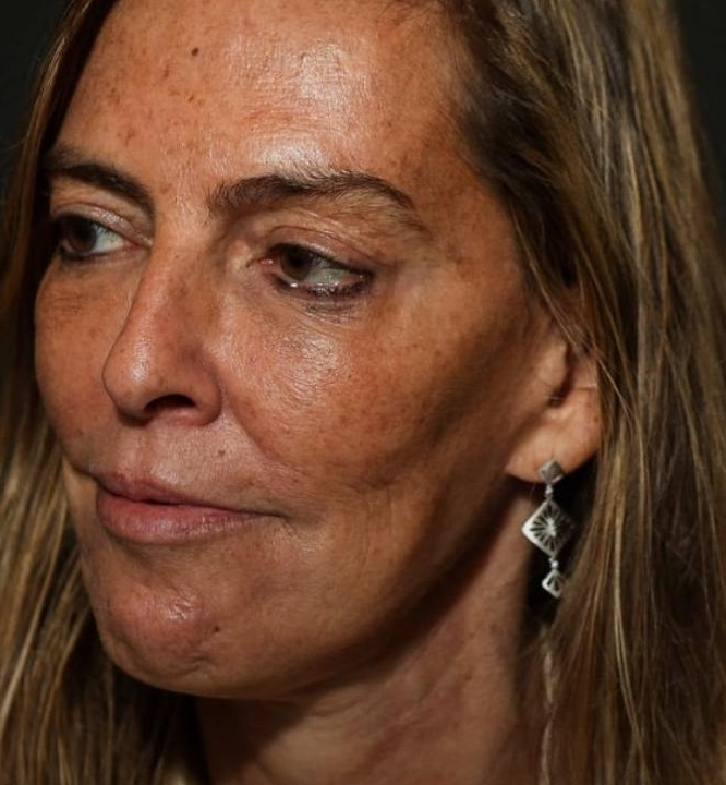 O Brasil perdeu a patente internacional da Polilaminina após cortes de recursos destinados a UFRJ em 2015 e 2016 no governo Dilma, diz pesquisadora; VEJA VÍDEO