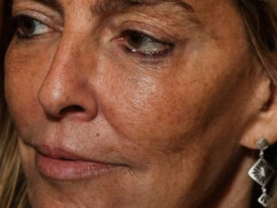 Brasil perdeu a patente internacional da Polilaminina apos cortes de recursos destinados a UFRJ no desgoverno Dilma do PT (que fez porto em Cuba, gastou milhões com artistas e carnaval). Veja vídeo de pesquisadora