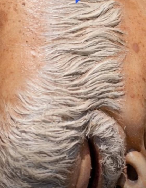 Fezes, deboche à família e boneco sem cabeça: vexame da Acadêmico de Niterói termina em rebaixamento humilhante