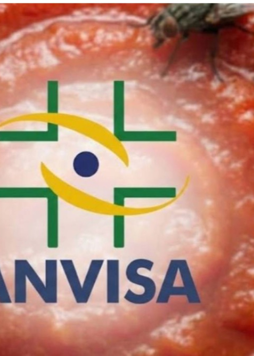 Pelo de rato, mosca e barata: Lei da Anvisa informa 3 produtos populares que podem conter insetos; VEJA QUAIS