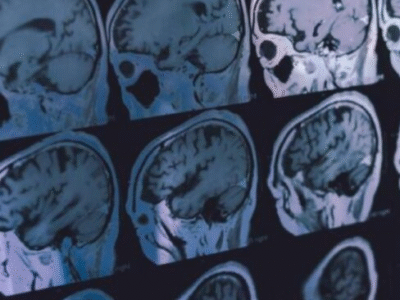 Novo estudo sobre o café que todo mundo deveria saber