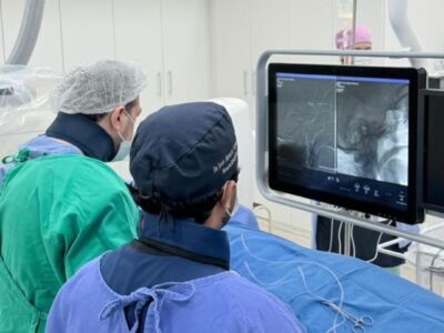 HBU realiza procedimento inédito e coloca Marília entre os centros com técnicas avançadas em neurocirurgia. A embolização da artéria meníngea média para o tratamento do hematoma subdural crônico. Conheça
