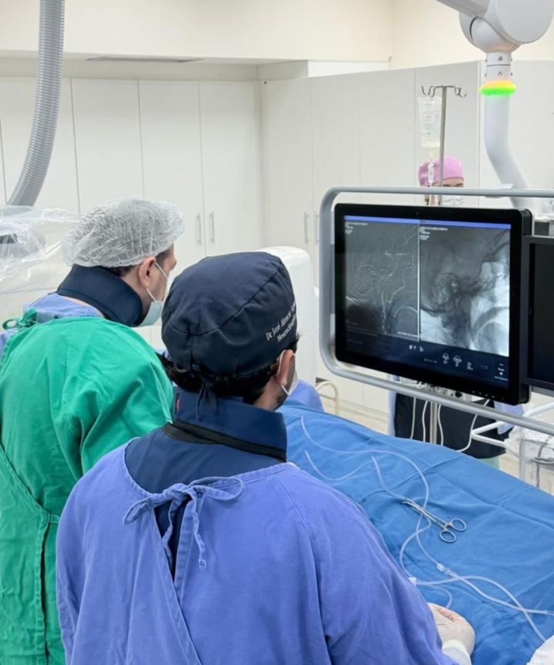 HBU realiza procedimento inédito e coloca Marília entre os centros com técnicas avançadas em neurocirurgia. A embolização da artéria meníngea média para o tratamento do hematoma subdural crônico. Conheça