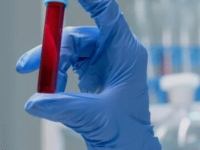 Exame de sangue simples pode mostrar quais pessoas viverão mais anos; ENTENDA