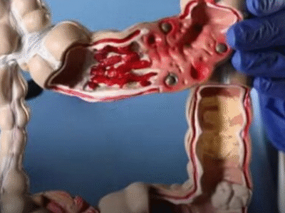 Esses sinais nunca podem ser ignorados, não importa a idade, alertam cirurgiões