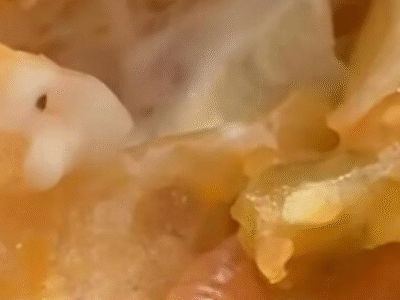 Cliente encontra larva dentro de lanche do McDonald’s; VEJA VÍDEO