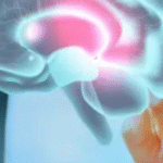 Aneurisma cerebral: entenda como identificar, sintomas e tratamentos