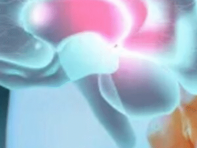 Aneurisma cerebral: entenda como identificar, sintomas e tratamentos