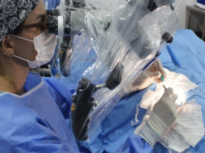 Procedimento cirúrgico inovador realizado na Santa Casa de Marília faz paciente de 22 anos recuperar a audição. Durante a cirurgia, foi implantado um dispositivo auditivo ancorado ao osso, conhecido como BAHA