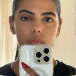 Jovem perde parte da visão após meses ignorando sinais de glaucoma; CONHEÇA SINAIS