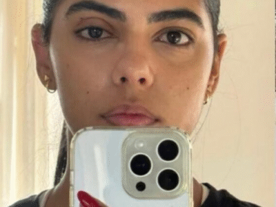 Jovem perde parte da visão após meses ignorando sinais de glaucoma; CONHEÇA SINAIS