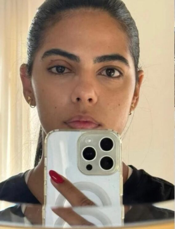 Jovem perde parte da visão após meses ignorando sinais de glaucoma; CONHEÇA SINAIS