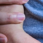 SAÚDE: cientistas testam injeção que pode regenerar o coração após infarto; SAIBA MAIS