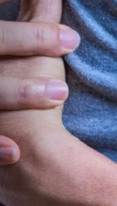 SAÚDE: cientistas testam injeção que pode regenerar o coração após infarto; SAIBA MAIS