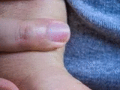 SAÚDE: cientistas testam injeção que pode regenerar o coração após infarto; SAIBA MAIS