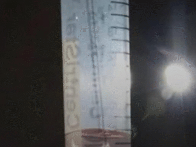 Teste do cotonete mostra boa eficácia para detectar Alzheimer precoce; VEJA