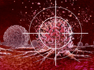Brasil entra na rota de testes para novas vacinas contra o câncer