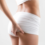 Celulite hormonal, da adolescência à menopausa: o que e como ela muda em cada fase do corpo feminino. Entenda com especialista