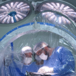 Parkinson: Santa Casa de Marília realiza procedimento inédito para tratamento da doença com implantação de chips cerebrais. Melhora significativa dos tremores, rigidez e lentidão dos movimentos