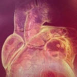 Cresce casos de infarto entre jovens e motivo é revelado