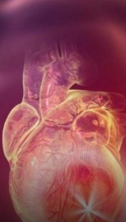 No momento, você está visualizando Cresce casos de infarto entre jovens e motivo é revelado