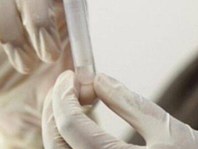 Esse Teste promete acabar com a endoscopia e expõe câncer de estômago logo no início; VEJA MAIS