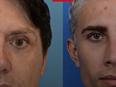 Homem com ordem de restrição faz 37 cirurgias plásticas e passa a usar outro nome para reencontrar sua ex