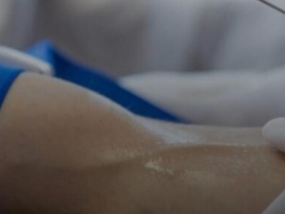 Novo exame de sangue é capaz de prevê com ajuda de IA, infarto e AVC em até 15 anos antes; VEJA