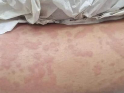 Suspeita de contaminação através de detergente Ypê é descartada