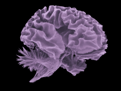 Transtorno bipolar e esquizofrenia: cientistas encontram o circuito cerebral que decide como as memórias serão armazenadas e organizadas. A desordem é uma das causas das doenças. Entenda