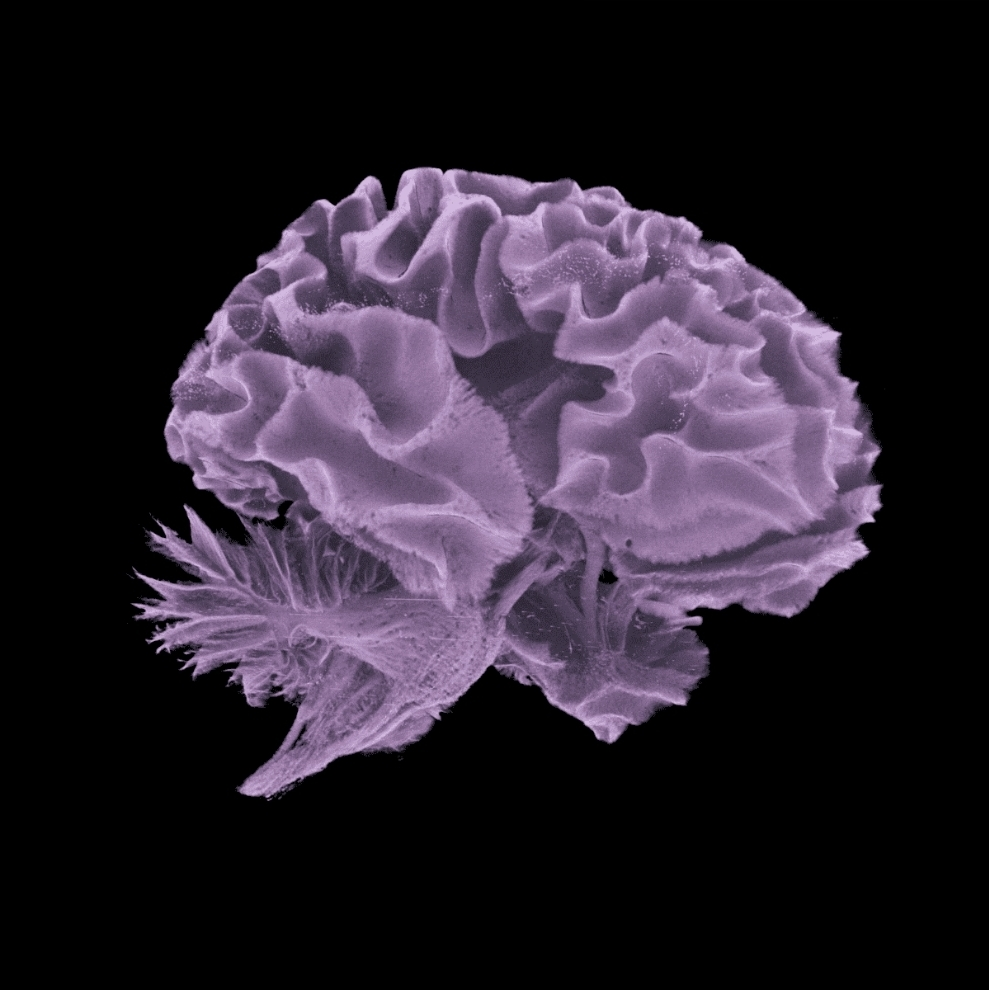 No momento, você está visualizando Transtorno bipolar e esquizofrenia: cientistas encontram o circuito cerebral que decide como as memórias serão armazenadas e organizadas. A desordem é uma das causas das doenças. Entenda