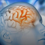 Esse novo medicamento contra Alzheimer pode reduzir declínio cognitivo em até 50%, VEJA