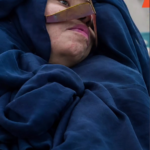 A incrível história da mulher que passou 27 anos em coma e ao acordar surpreende com uma pergunta;VEJA