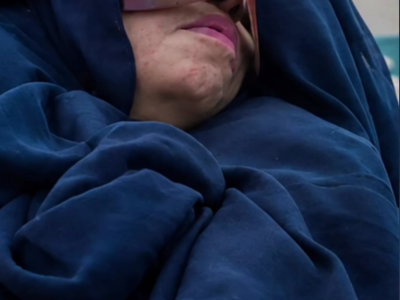 A incrível história da mulher que passou 27 anos em coma e ao acordar surpreende com uma pergunta;VEJA