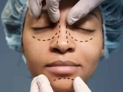 TRF-1 considera ilegal norma que autorizava dentistas a realizar procedimentos de harmonização facial