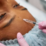 TRF1 anula regra que permitia harmonização facial por dentistas