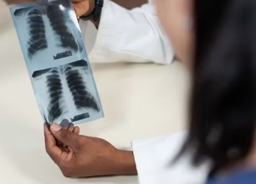 No momento, você está visualizando SUS: três novos medicamentos contra câncer de pulmão chegam em outubro