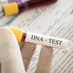 Alteração no DNA pode explicar progressão de câncer cerebral em jovens. Pesquisa identifica mudanças epigenéticas que ajudam a explicar resposta desigual ao tratamento