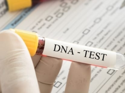 Alteração no DNA pode explicar progressão de câncer cerebral em jovens. Pesquisa identifica mudanças epigenéticas que ajudam a explicar resposta desigual ao tratamento