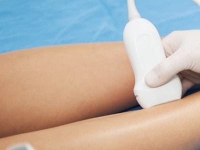 Cuidar da circulação também faz parte da rotina. Pequenas mudanças no dia a dia podem contribuir para uma circulação mais saudável e ajudar na prevenção da trombose. Entenda