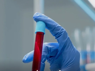 Novo exame de sangue chega ao Brasil com uma promessa que pode mudar a detecção do câncer; veja detalhes