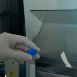 Exame de sangue para Alzheimer acaba de chegar ao Brasil; saiba quanto custa e o que o exame revela